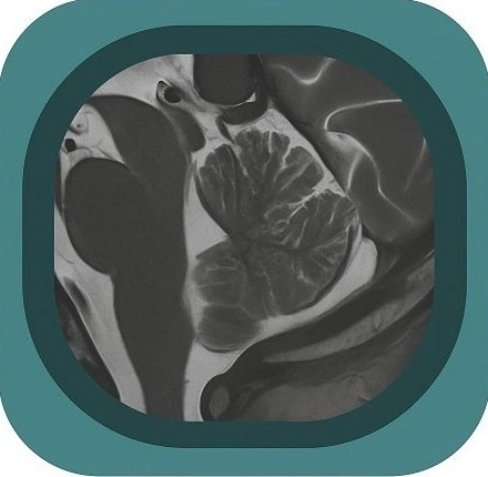 mri cerebellum anatomy icon